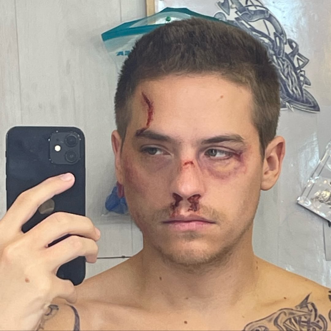 Dylan Sprouse