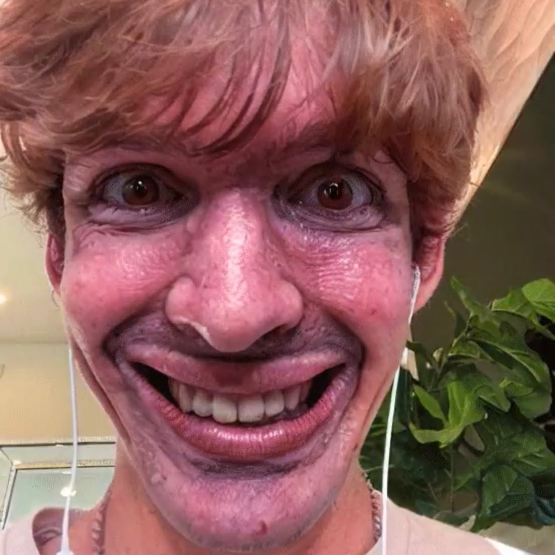 Albert