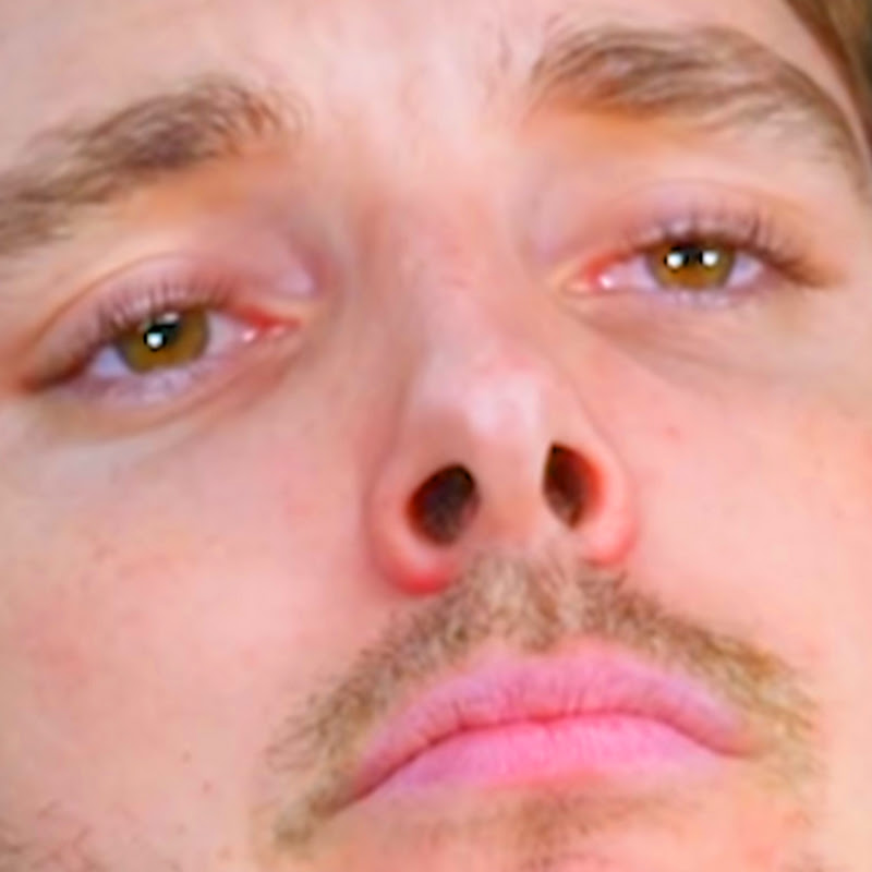 Lazar Beam
